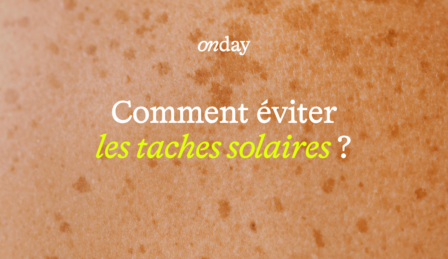 Taches solaires : pourquoi elles apparaissent à la fin de l'été ? ☀️